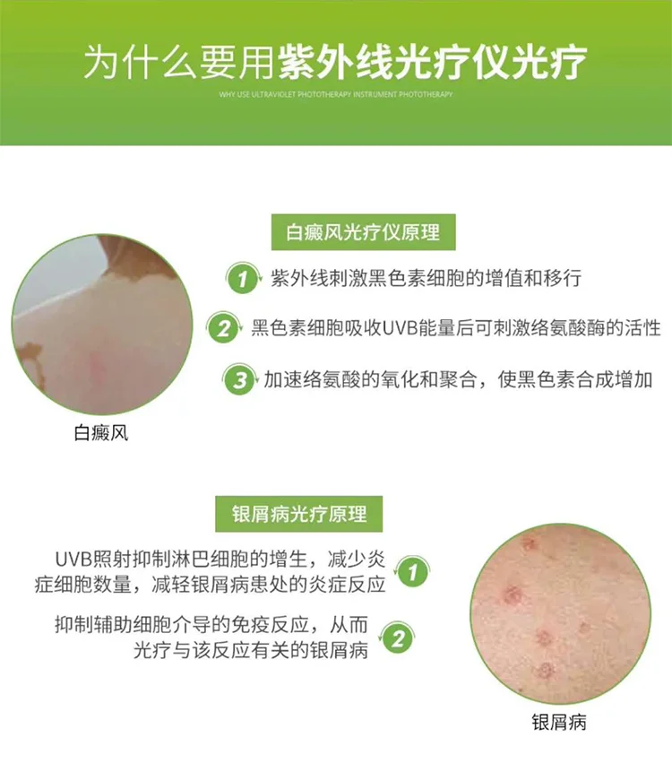 Vitiligo 308nm excimer фототерапевтическое устройство uvb белое пятно ультрафиолетовое лазерное лечение лампа псориаз дом подлинный