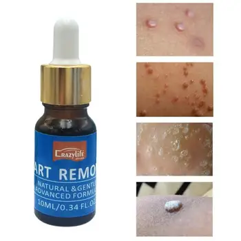 

Feet Corn Remover Powerful Foot Fingers Callus Remover Liquid Body Warts Treatment Smooth Skin Rejuvenation Safe Skin Care