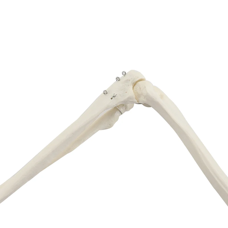 Human Upper Limb Arm and Radius Hand Bone Anatomy Model Medical Science Teaching Resources anatomical models