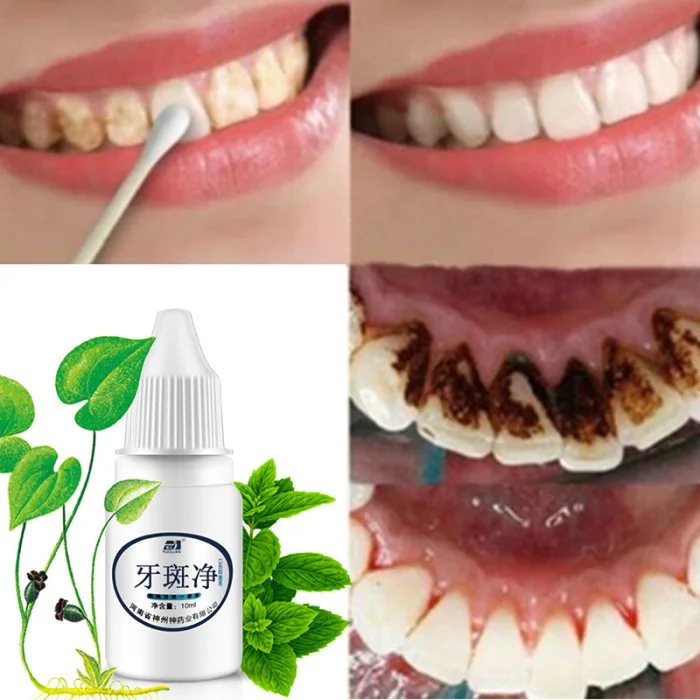 10ml Teeth Whitening Liquid Tooth Oral Hygiene Cleaning Teeth Care Paste Quick Effect Yellow Dental Plaque Dental Tattoo Black