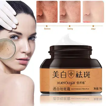 

Freckle Cream For Females Whitening Face Brightening Care Spots Moisturizing Skin Dark Cream Skin Fading W4D1