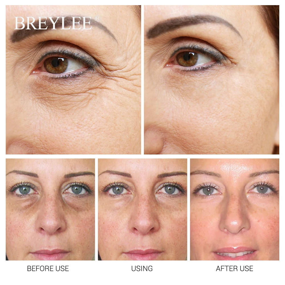 BREYLEE Gold Osmanthus Fragrans Eye Mask Collagen Gel Eye Patch Face Skin Care Remove Dark Circles Lifting Firming Serum 50pcs  (5)