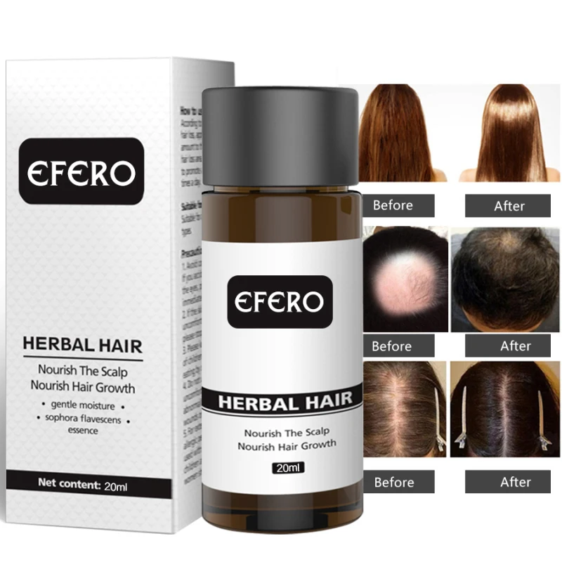 Gran venta EFERO previene la pérdida de cabello producto aceite esencial para el crecimiento del cabello fácil de llevar cuidado del cabello enfermería 20ml ambos hombres y mujeres pueden UseTSTM1 YypdOke8o