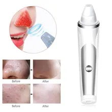 Вакуумный отсос для угрей, средство для удаления акне, косметический прибор для лица, глубокое очищение, очиститель пор, удаление 3 скоростей, АБС-пластик, инструменты для ухода за кожей