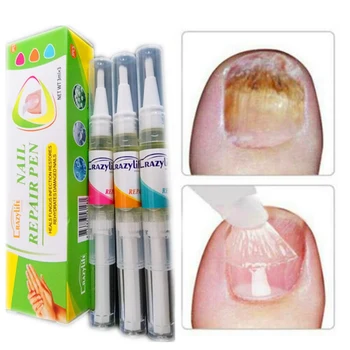 

3Pcs Nail Repair Solution Effective Against Nail Fungus, Repair Essence For Treating Onychomycosis & Paronychia Nail Care