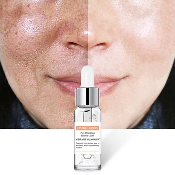 

Salicylic Acid Solution Control Oil Remove Pimples Blackheads Serum Vitamina C Serum Facial Pores Shrinking Essential Liquid*s