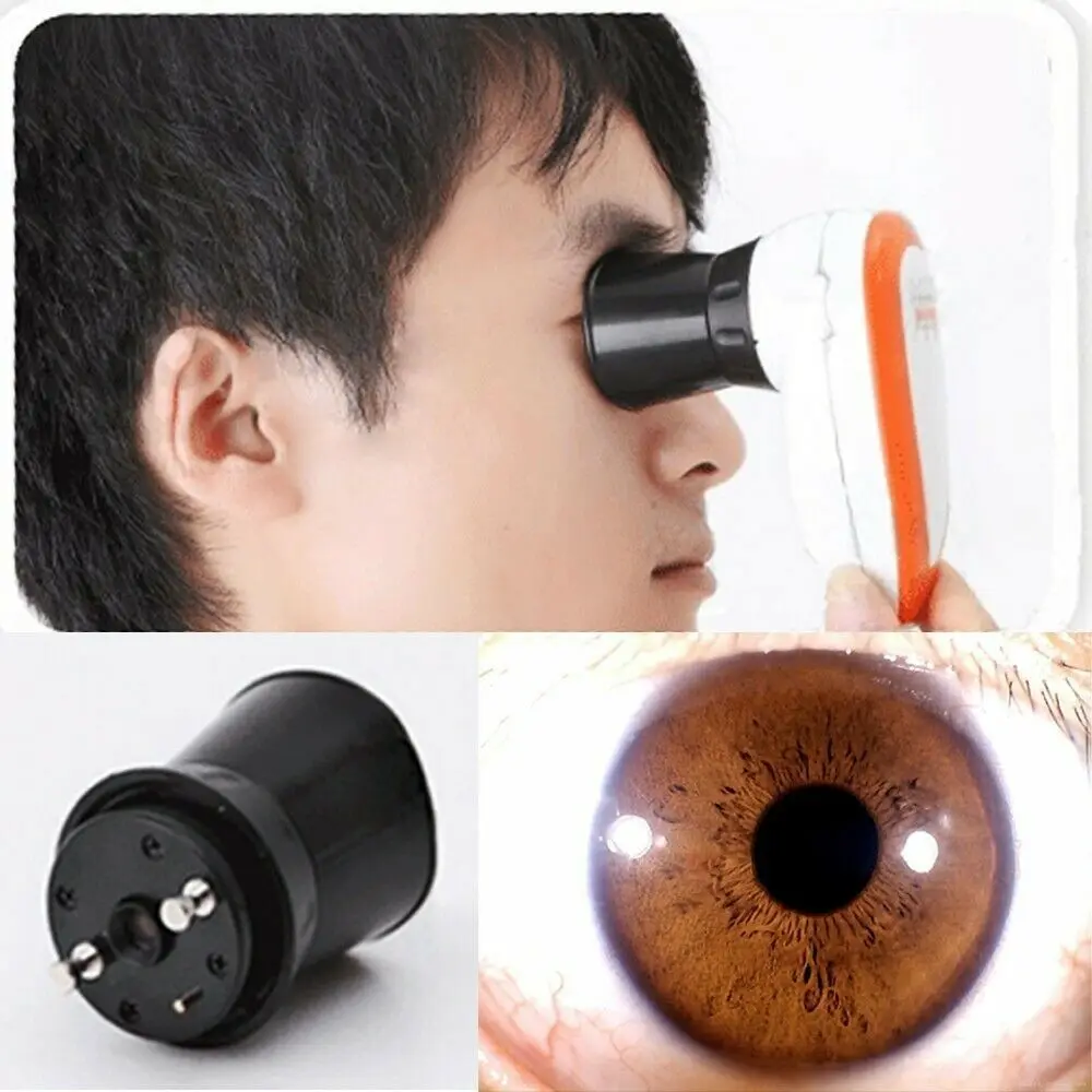 

5.0MP 30x Iris Magnifying Lens USB DigitaI Eye Analyzer Detector Eye Ridology Camera Magnifier
