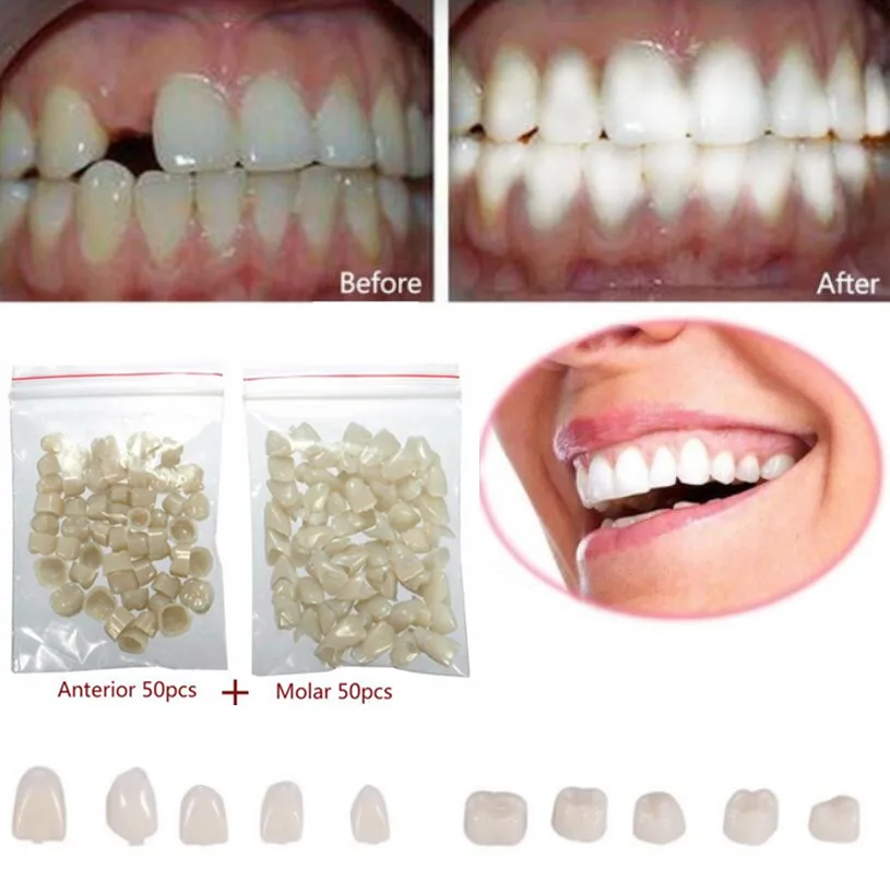 2 упаковки стоматологических материалов смешанные временные виниры в форме