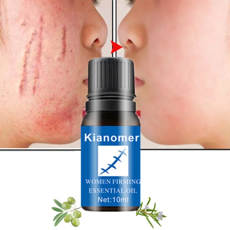 10ml Scars Removal Oil Nourishing Skin Lightening Pigment Acne Marks Scars Remover