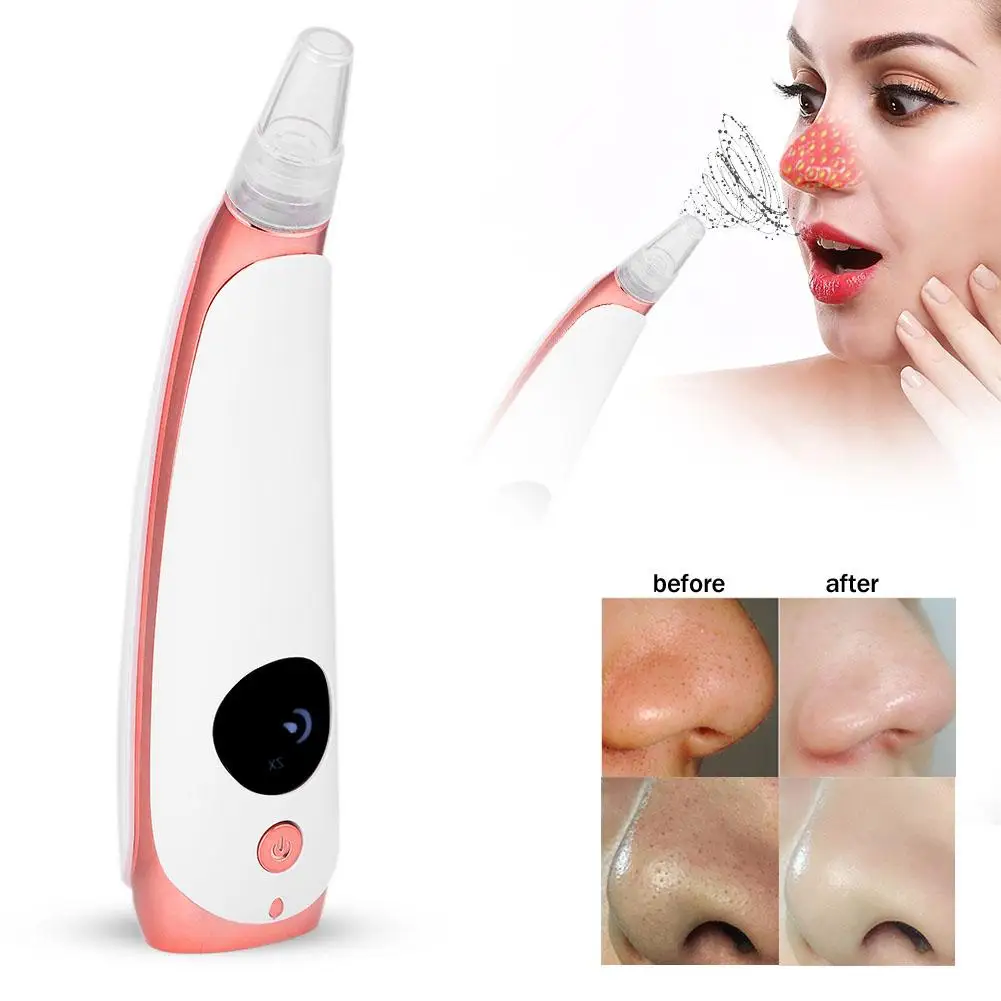 Вакуумный очиститель пор лица derma suction. Dermasuction вакуумный очиститель пор для лица. Машинка для удаления черных точек на лице без вакуума. Вакуумный очиститель пор лица derma suction купить. Derma suction насадки.