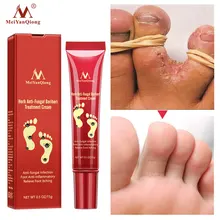 Herbal Foot Cream Anti Fungal Infection Anti-inflammatory Fungus Feet Relieve Itching Gel Repair Dry Crack Feet Care Cream 15G