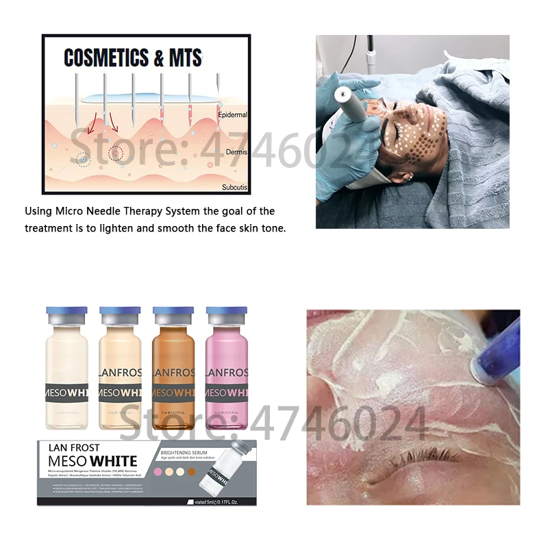 BB сыворотка Формальный набор Mesowhite Сыворотка для отбеливания кожи BB Жидкий тональный крем светящийся микс оттенков Профессиональный для дермы ручка МТС лечение