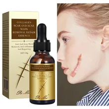 

Repair Scar Removal Oil Gel Whitening Lighten Acne Scars Scald Surgical Scar Treat Cream Collagen Suplement Smooth Skin 30ML