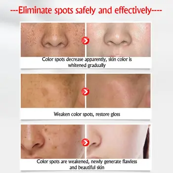 

25g Face Collagen Freckles Cream Whitening Stains Melanin Remover Anti-Aging Anti-Wrinkle Firming Brighten Skin Care Lotion