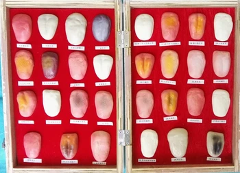 

All 30 Kinds of Human Tongue Lesion Models Oral Care Medical Teaching Model Human Tongue Pathology Model Medical Anatomy Models