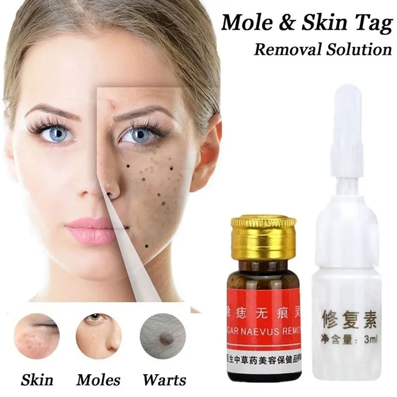 

Freckle Removal Cream Facial Clen Set Removal Solution Oil 3.0ml Face Care Acne Treatment Professional Painless Scar Remover