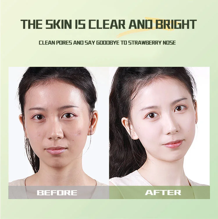 máscara facial chá verde gelo máscara de lama muscular limpeza profunda remover cravos encolher poros máscara facial cuidados com pele produtos