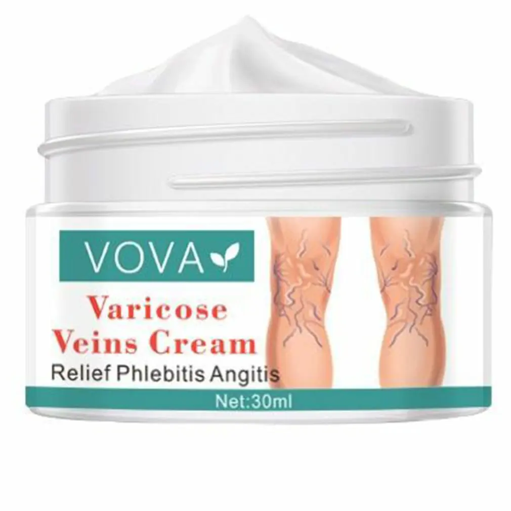 Varicose Veins Cream 30ml Nourish Soothe Phlebitis Remove Spider