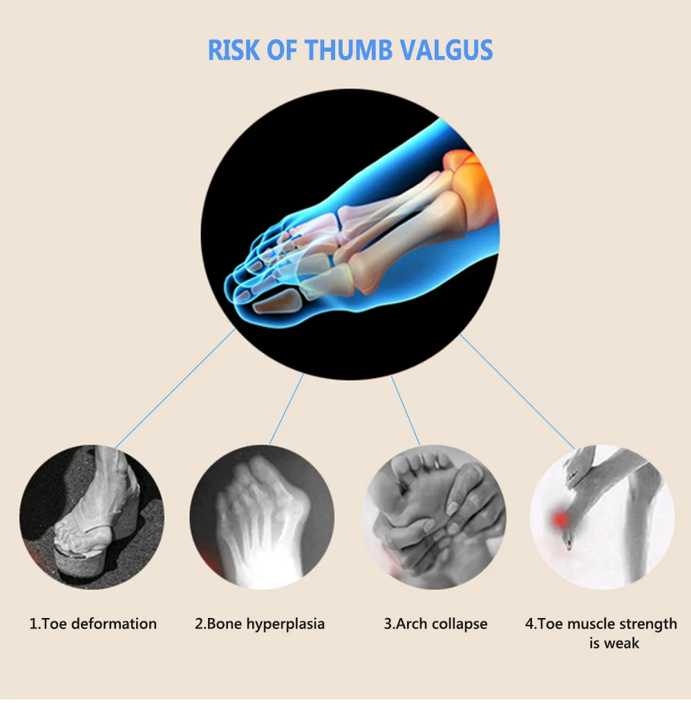 Вальгусная деформация, небольшая коррекция большого пальца ноги, разделитель большого пальца, защита носка стопы, выпрямитель, корректор, облегчение боли, стельки