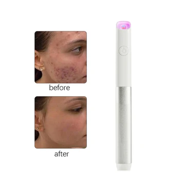 

Acne Spot Laster Pen Facial Vibration Massage Instrument Electronic Negative Galvan Ion Import Export Tool Face Care Massager