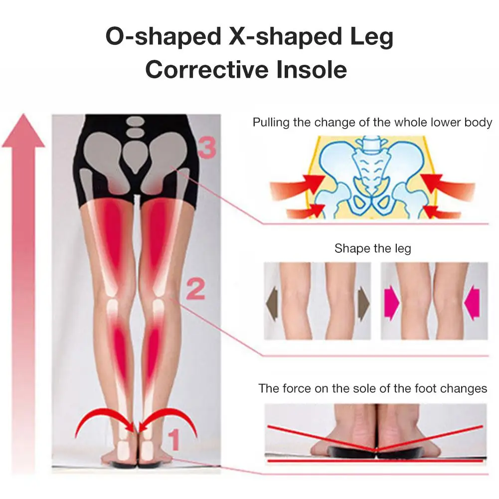 Коррекция пятки коврик силикон для взрослых O-type X-shaped пластиковая ножка стелька для ног Коррекция пятки колодки плоский поддержка свода стопы