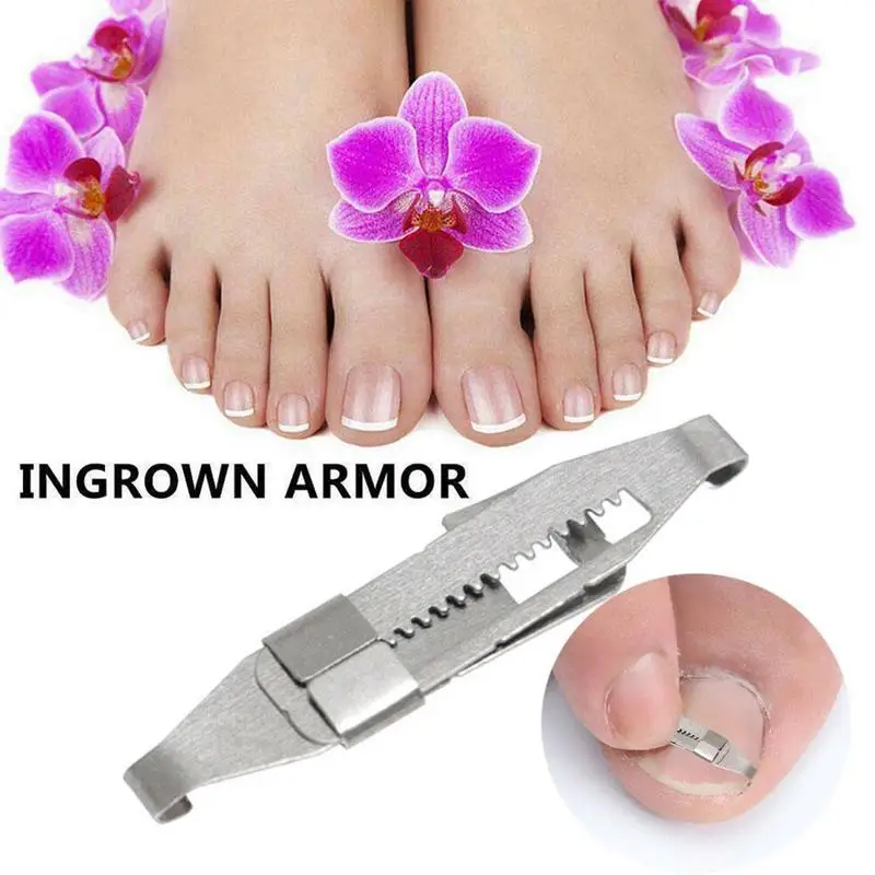 Ingrown Toenail Corrector Toenail Correction Treatment Corrector Foot Embed Orthotic Tools Nail Tool Fixer Recover Pedicure S1H3 Ingrown Toenail Corrector Toenail Correction Treatment Corrector Foot Embed Orthotic Tools Nail Tool Fixer Recover Pedicure S1H3