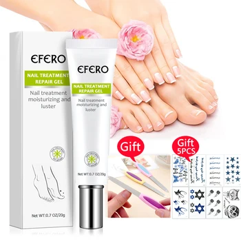 

Fungal Nail Treatment Repair Serum Whitening Foot Nail Fungus Removal Gel Anti Infection Paronychia Onychomycosis Nail Care Gel