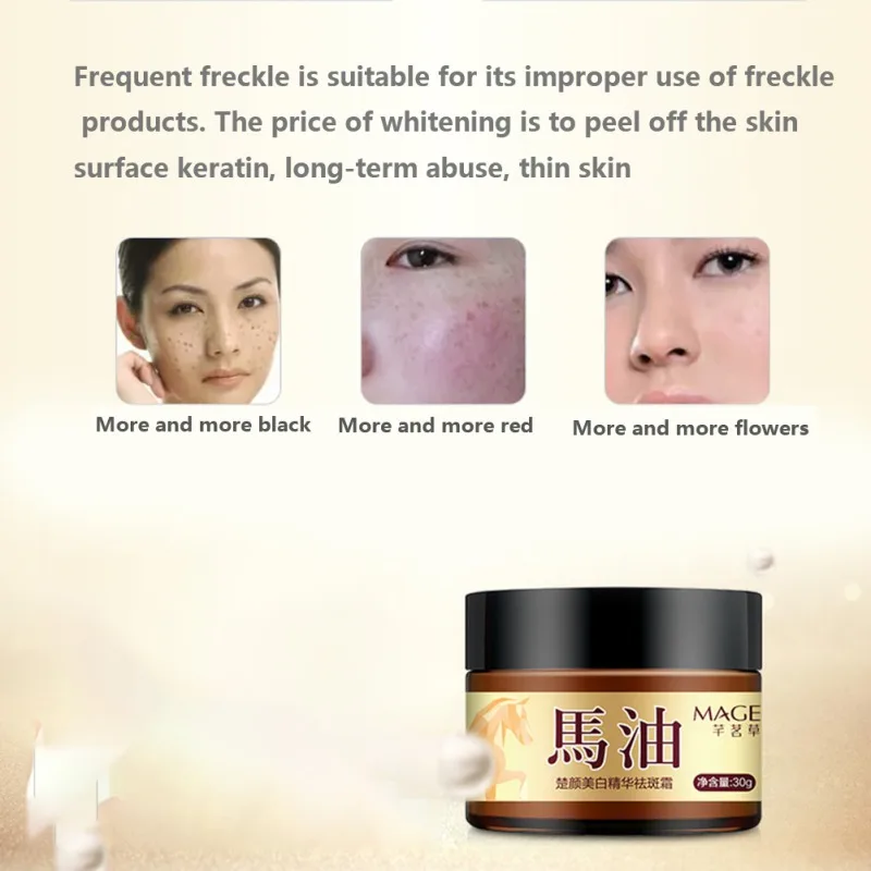Лошадиное масло веснушки крем Увлажняющий Осветляющий пигмент Осветляющий тон кожи крем против веснушек