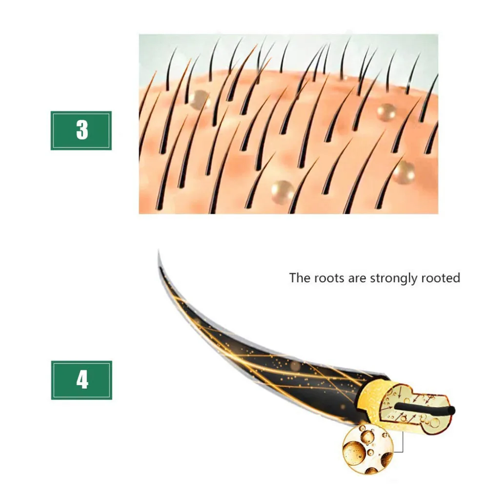 3 шт. удобрения для волос ускоренный рост волос жидкость средство для роста волос здоровая Сыворотка для волос ремонт растущий более быстрое лечение потери 3 шт