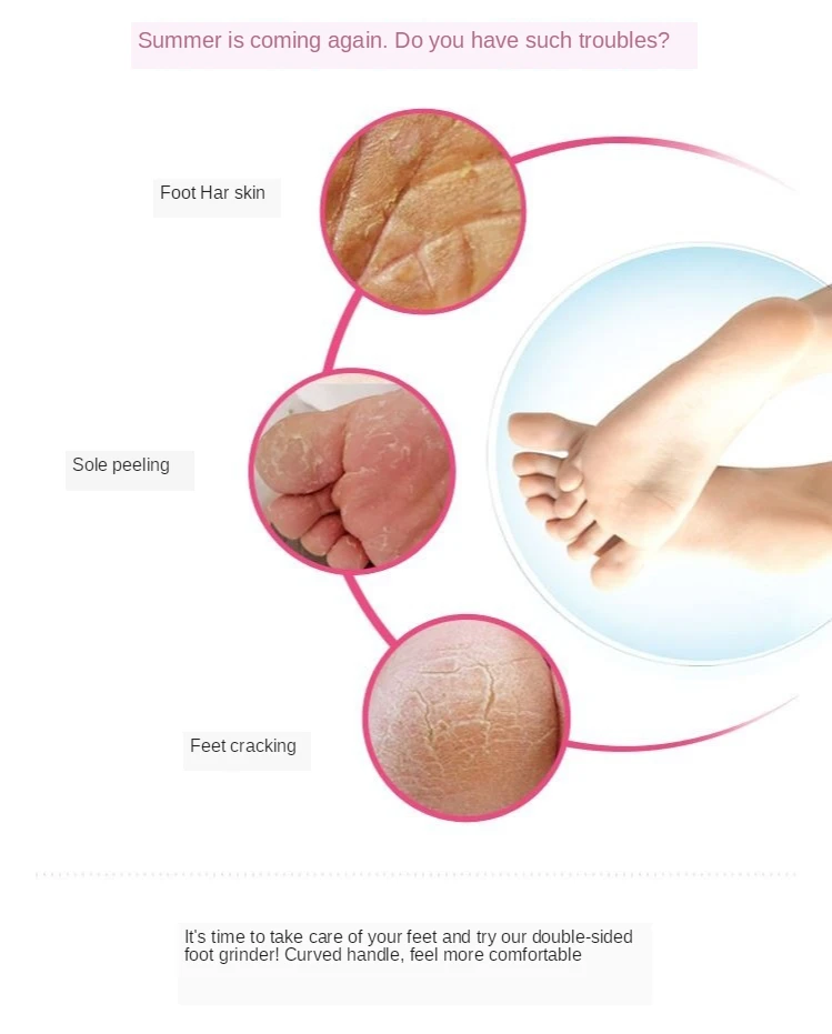 11329230306_356674875