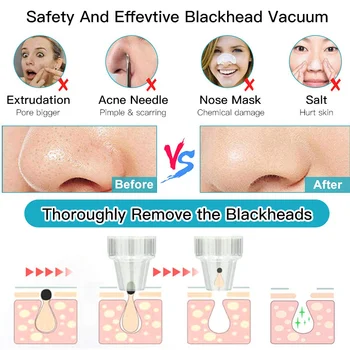 

Electric Acne Remover Blackhead Remover Face Deep Nose Cleaner Face Pore Vacuum Skin Care USB Rechargeable Facial Tools Suction