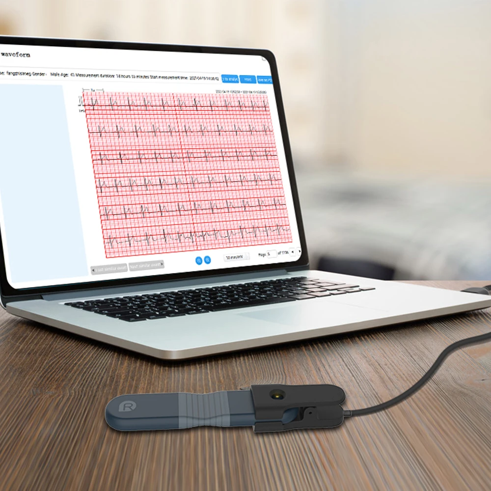 Wellue ER1 AI Analysis Ecg Machine Portable Heart Rate Monitor Chest