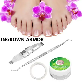 

Toe Nail Recover Toenail Correction Pedicure Fixer Tool Toenail Wire Fixer Clippers Straightener Ingrown Clip Straightening T3Z9