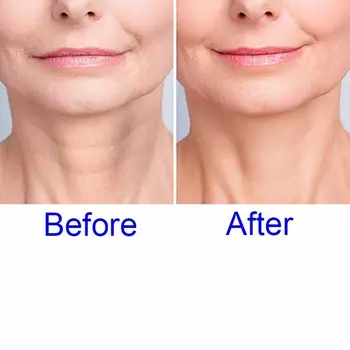 

Transparent Anti Microgroove Anti Wrinkle Neck Pad Reusable Silicon Removal Neck Sticker Skin Care Silica Gel Patch TSLM2