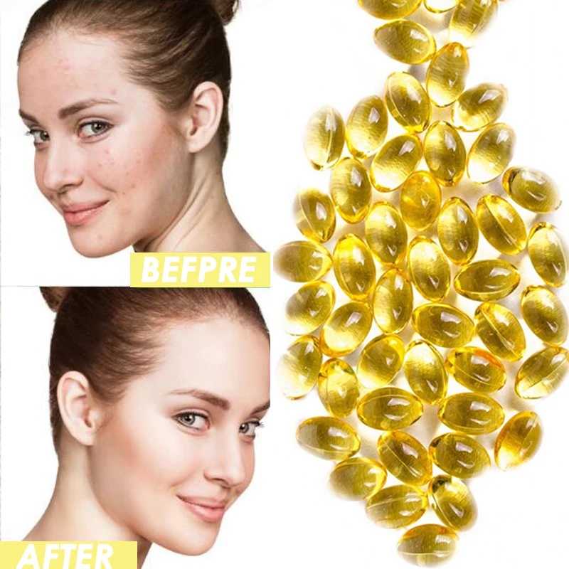 10/20/50/100 шт. новые капсулы витамина е для искусственной эссенции антивозрастная