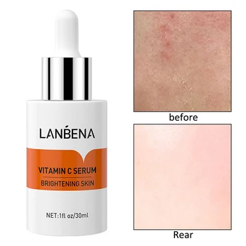 

Face Serum Moisturizing Collenage Essence Sensitive Skin Repair Acne Treatment Anti Wrinkle Remove Fine Lines Skin Care TSLM1