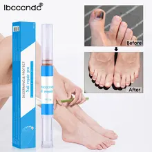 Эффективное удаление грибка ручка для лечения ногтей травы восстанавливающая жидкость для ногтей Onychomycosis Paronychia противогрибковые инструменты для дизайна ногтей TSLM1