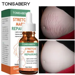 Maternity Scars Remover Essential Oil Pregnancy Stretch Marks Remove Cream Firming Body Slackline Skin Care Repair Pregnant Oils