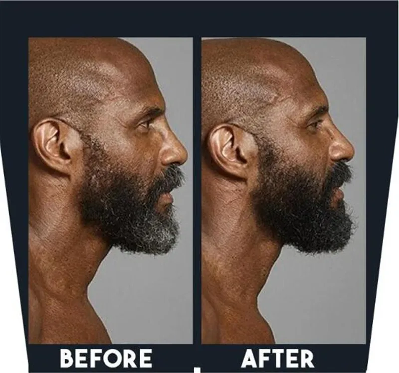 Before And After Mustache Dye