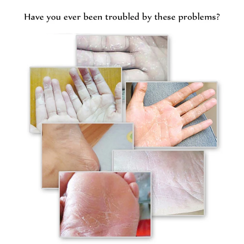 

Banana Hand Foot Crack Cream Heel Chapped Peeling Foot Hand Repair Anti Dry Remove Dead Skin Soften Cream