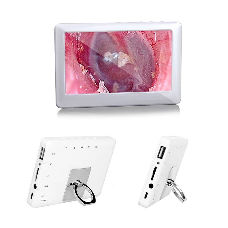 Spetu 3 9 мм отоскопы 4 дюймов LED дисплеем для чистки ушей эндоскоп HD 1080P визуальная