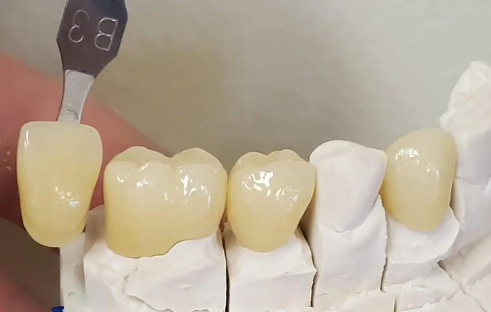 UT extreme 5 шт. 201519 мм sirona/ Cerec эстетика Многослойные ультрапрозрачные высокопрочные