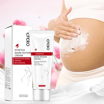 preço Cuidados Com A Pele Do Corpo Da Cicatriz Da Remoção Do Creme Do Reparo Da Marca De Estiramento Para A Gravidez