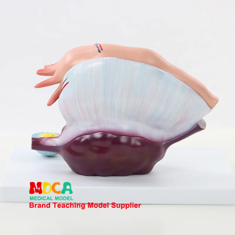 Ovarian Structure Amplifier Model Family Planning Ovarian Demo Model Medicine Teaching Mszxt008
