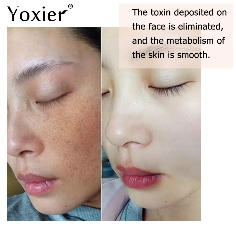 Yoxier Guasha Scraping Massage Acupoint Face Eye Care SPA Massage Face Massager Acupuncture Relaxation Health Care 3