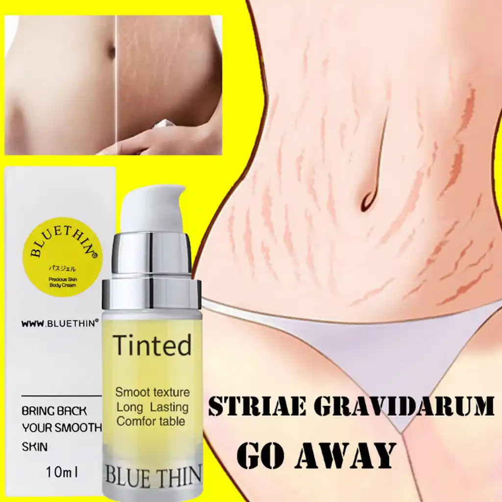 postpartum creams belly