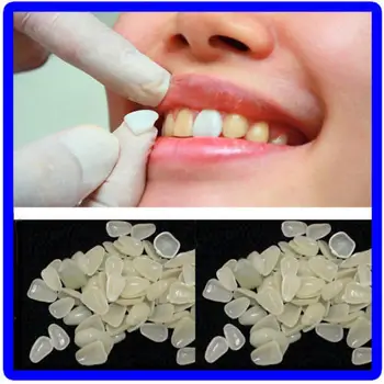 

70 Pcs Temporary Resin Dental Sticker Shade Dental Whitening Veneers Teeth Upper Beauty
