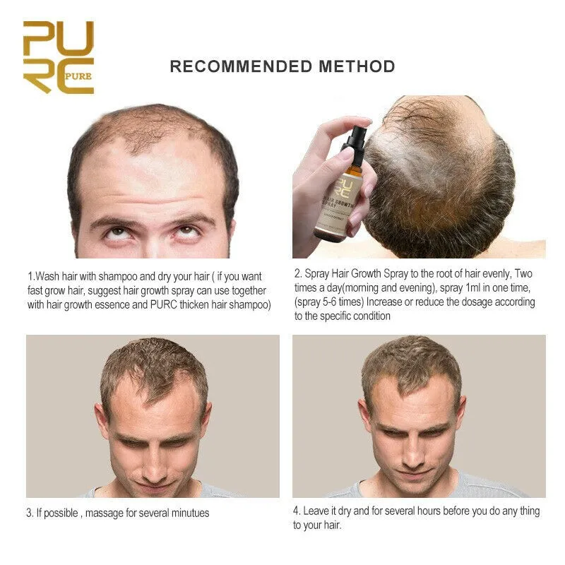 Спрей для роста волос 30 мл Gro, w восстановление укрепляет лечение облысения волос быстрое средство для роста волос масло для ухода за волосами Pr