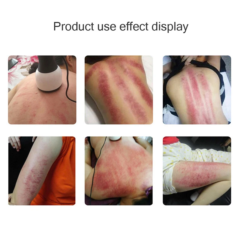 Natural Stone Needle Heating Scraping Massager Electric Body Guasha Massage Lose Weight Dredging Collaterals Detox Health Care 4