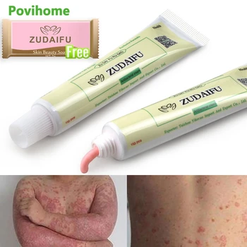 

1pcs Psoriasis Cream Eczema Skin Cream Dermatitis Eczematoid Eczema Anti-Itching Body Ointment Buy 1pcs Get Herbal Soap P1129